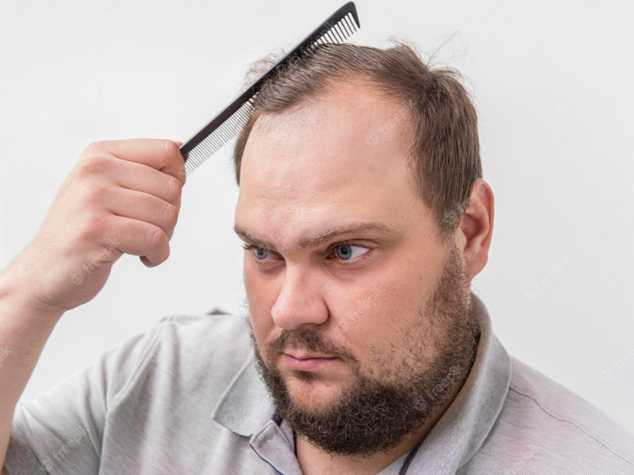 taglio capelli uomo stempiato