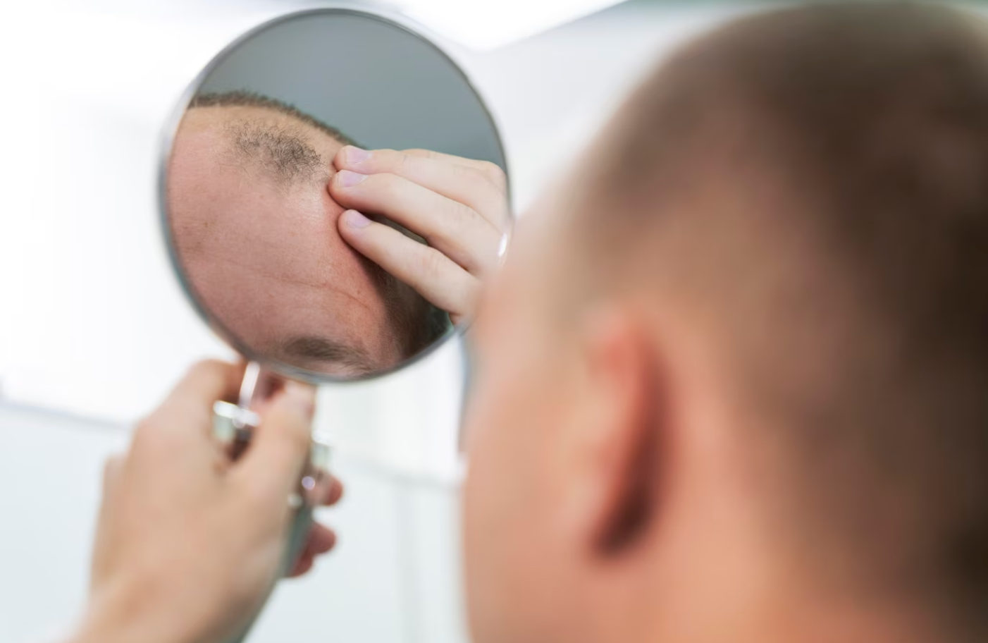 infoltimento capelli